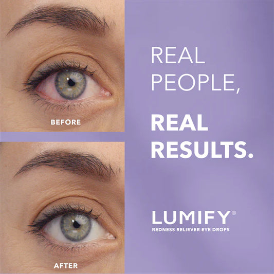 Redness Reliever Eye Drops