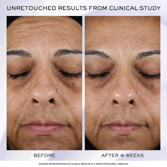 Rénergie H.P.N. 300-Peptide Anti-Aging Cream