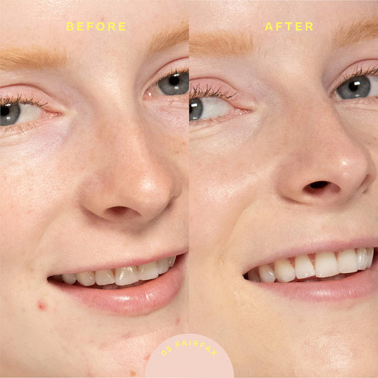 SunnyDays SPF 30 Tinted Sunscreen Foundation