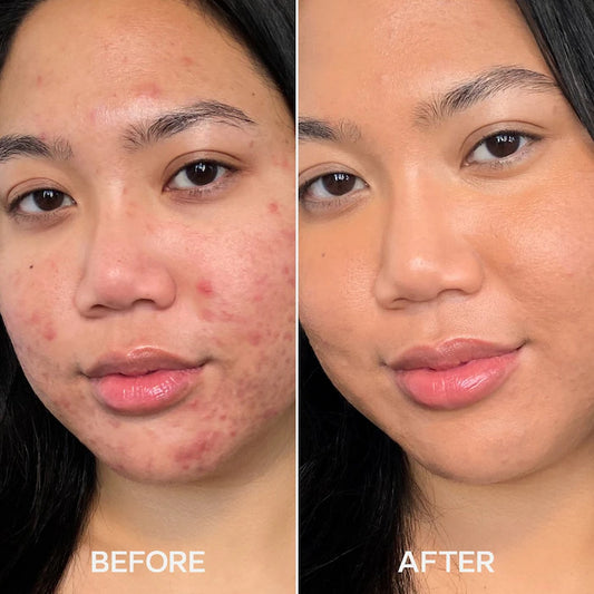 Hydrabeam Hydrating & Concealing Under Eye Brightener with Cucumber Extract