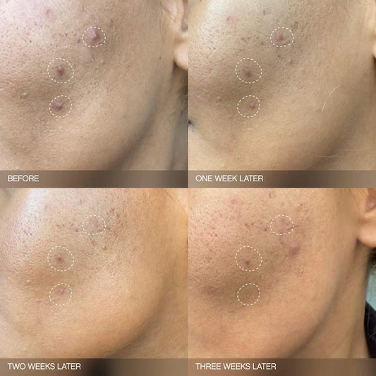 Faded Brightening Serum for Dark Spots and Discoloration