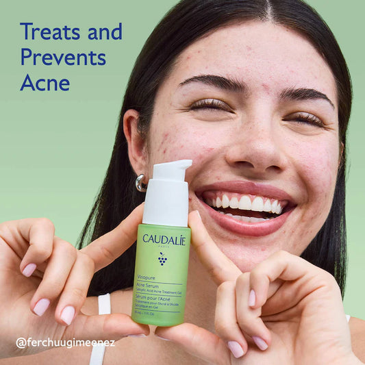 Vinopure Acne Serum to Treat and Prevent Blemishes