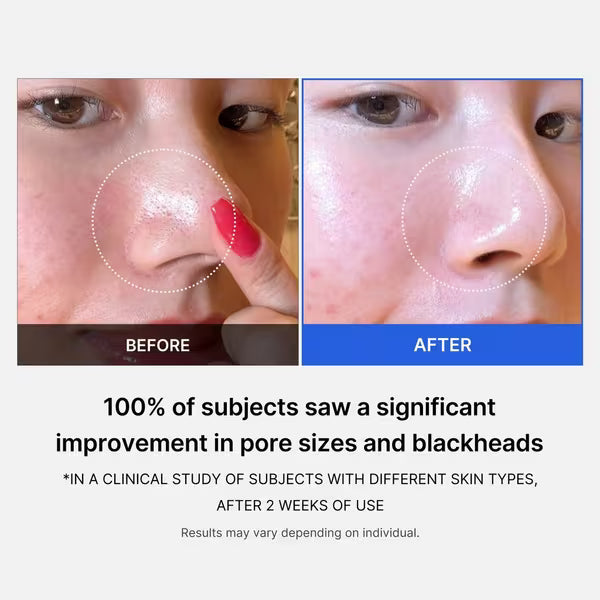 Zero Pore Pad