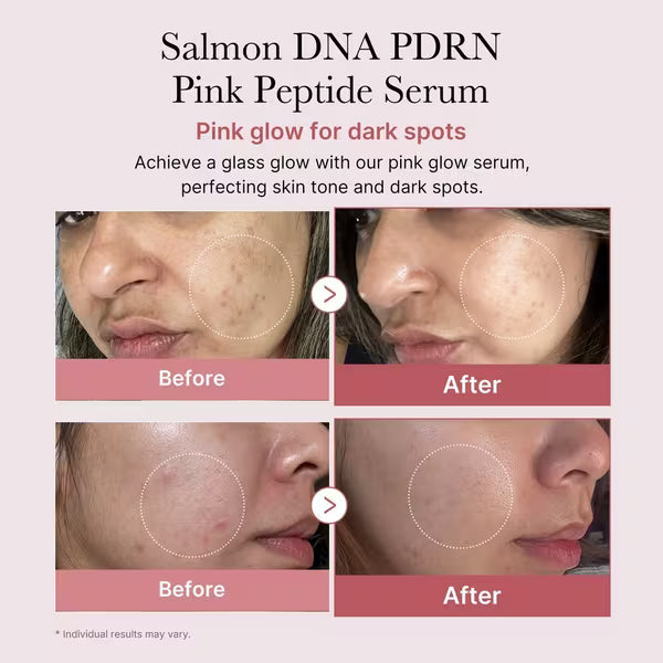 PDRN Pink Peptide Serum