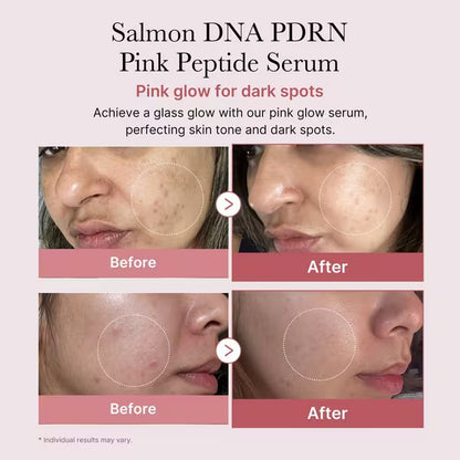 PDRN Pink Peptide Serum