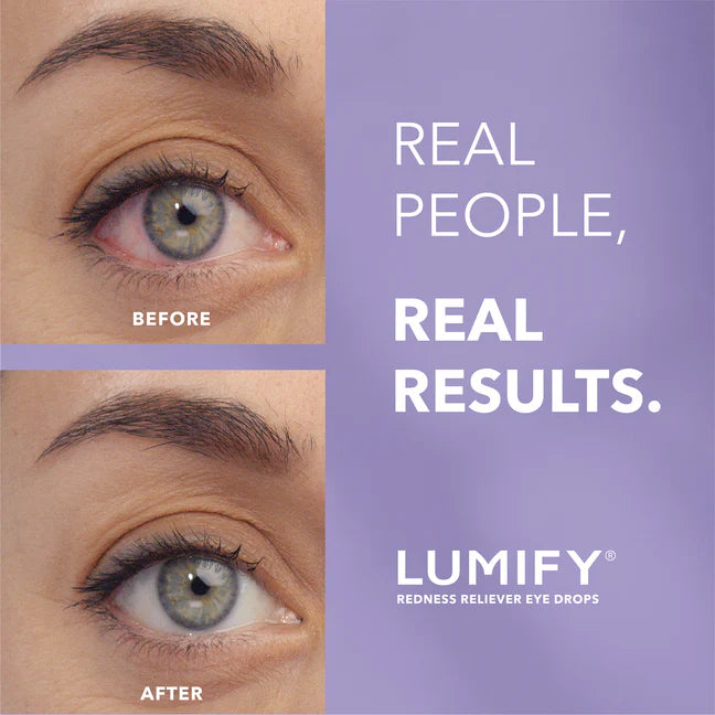 Redness Reliever Eye Drops