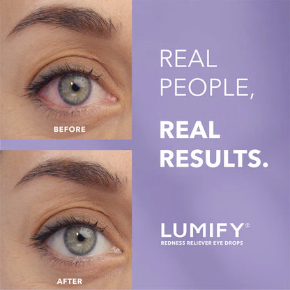 Redness Reliever Eye Drops