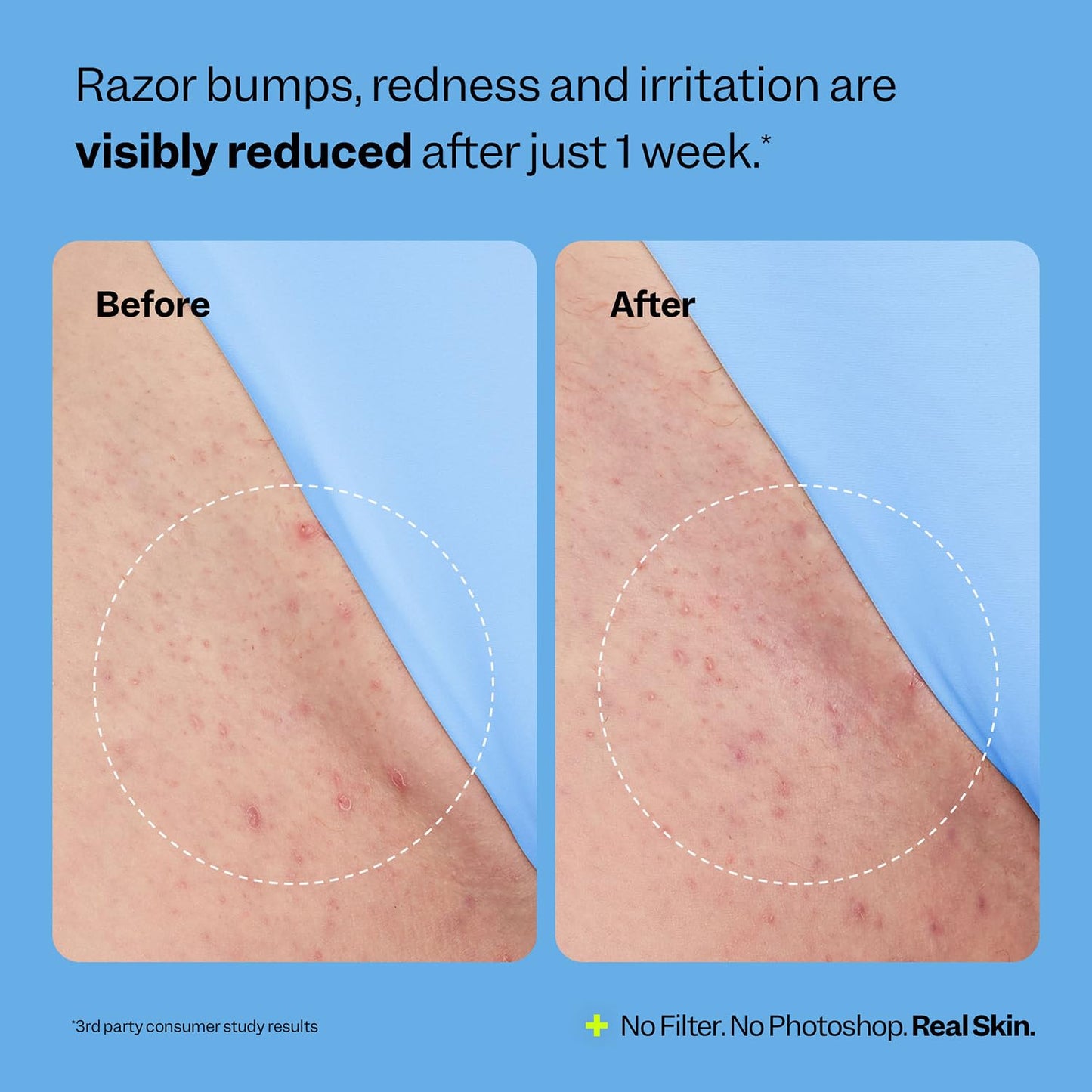 Smoothing Solution Ingrown Hair Treatment