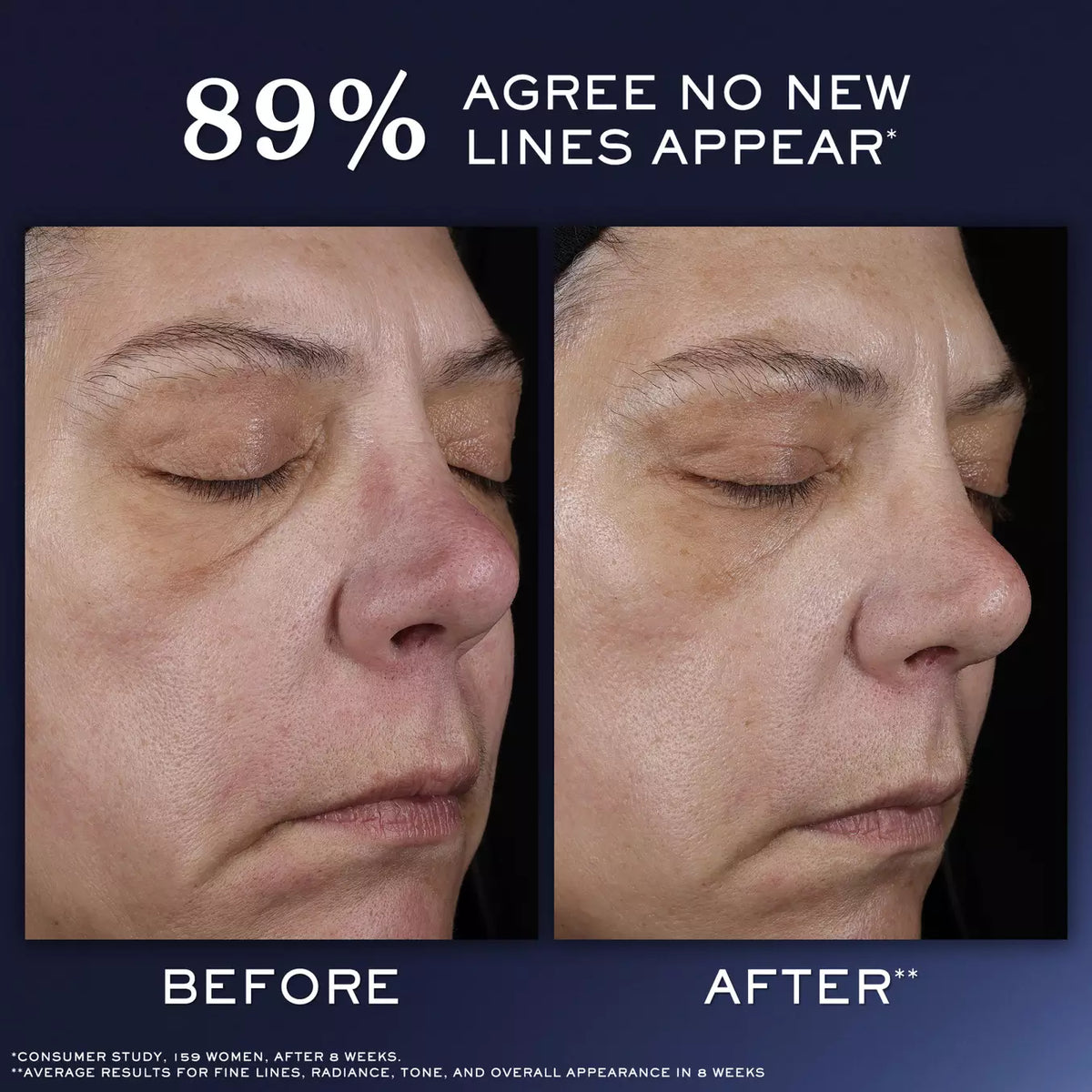 Ultimate Skin Recovery Routine
