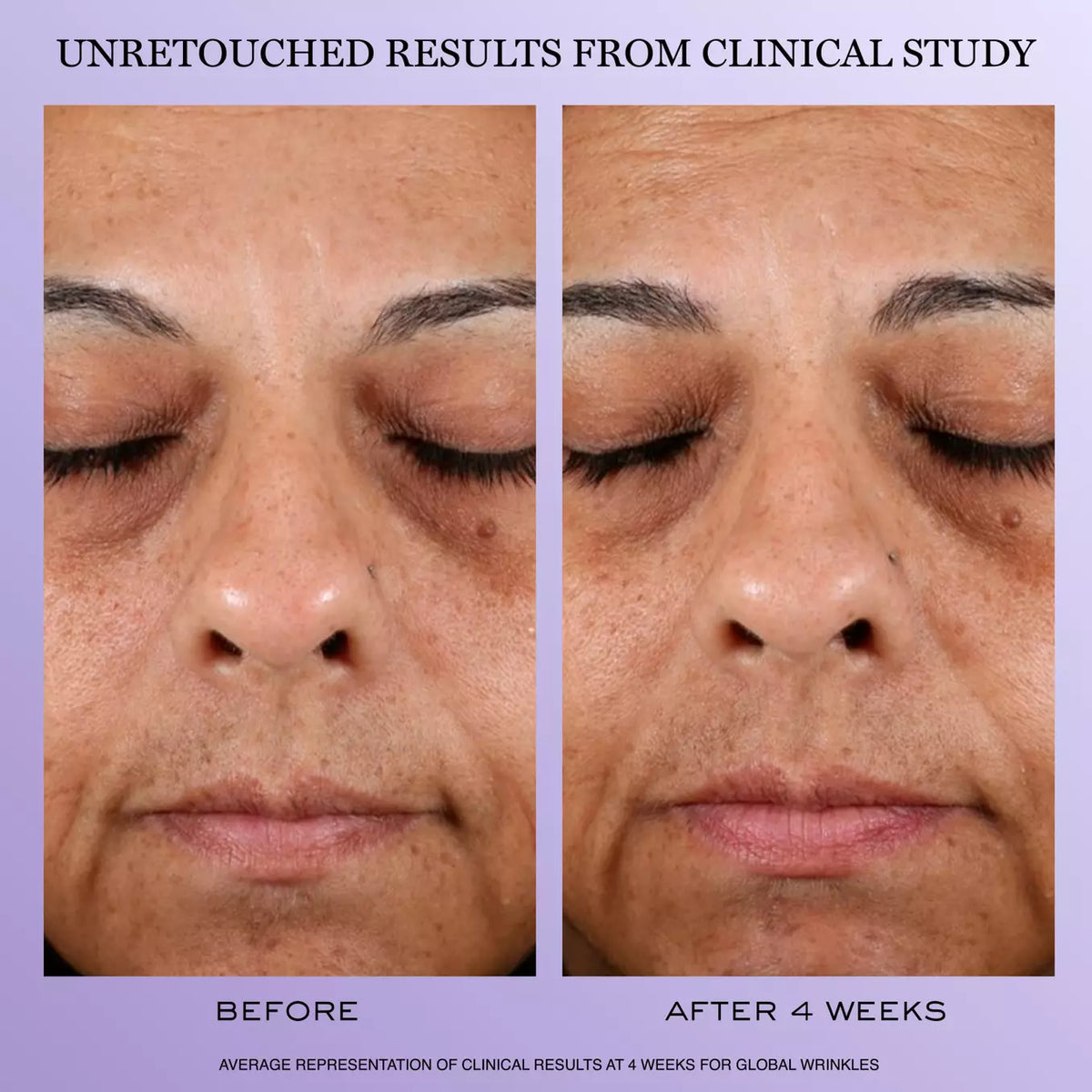 Ultimate Skin Recovery Routine