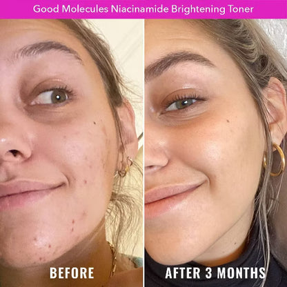 Good Molecules Niacinamide Brightening Face Toner