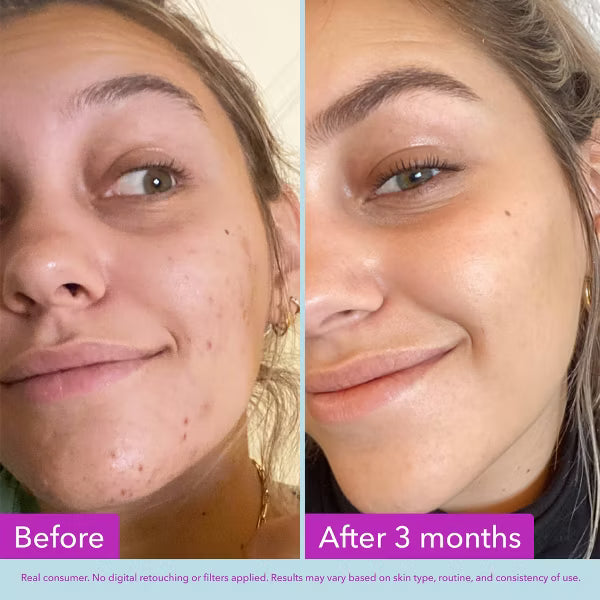 Good Molecules Niacinamide Brightening Face Toner