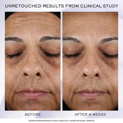 Rénergie H.P.N. 300-Peptide Anti-Aging Cream