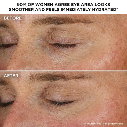 Bye Bye Under Eye Brightening Eye Cream for Dark Circles