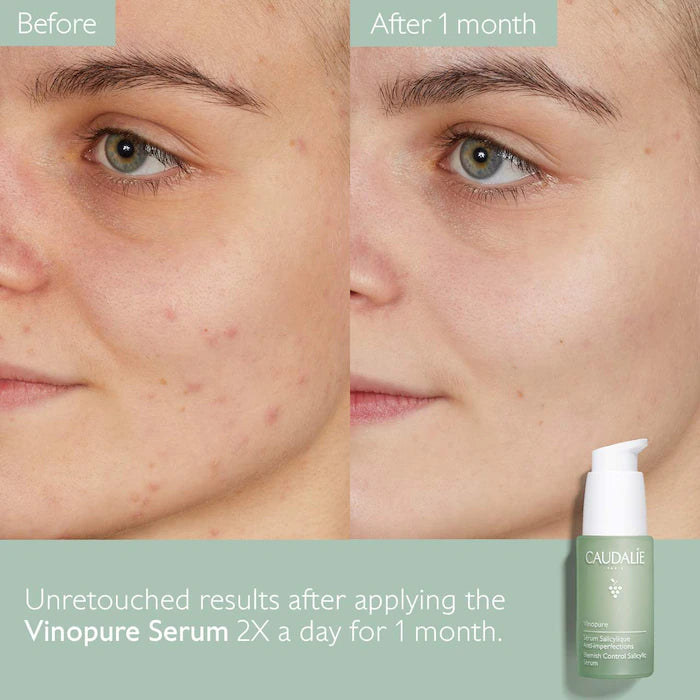 Vinopure Natural Salicylic Acid Pore Minimizing Serum