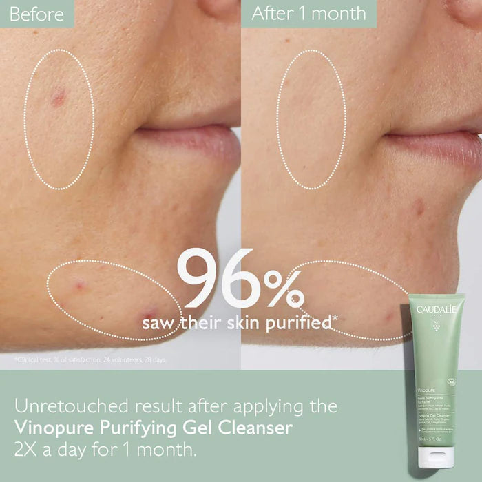Vinopure Pore Purifying Gel Cleanser