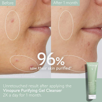 Vinopure Pore Purifying Gel Cleanser