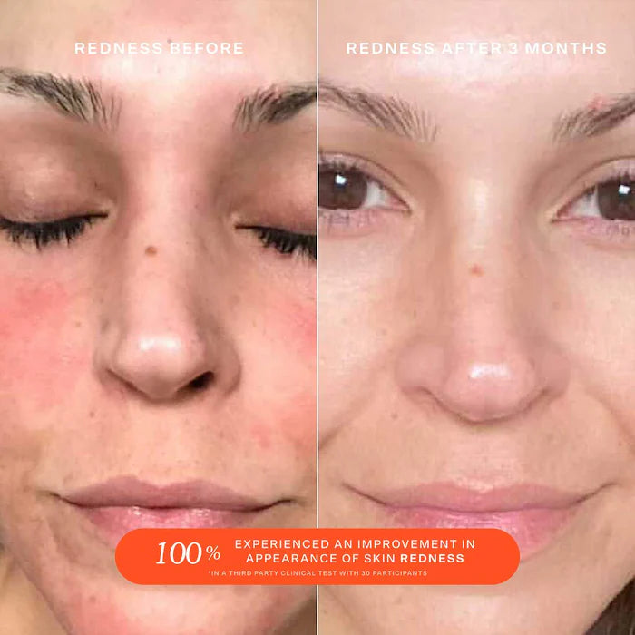 SOS Daily Rescue Facial Spray with Hypochlorous Acid