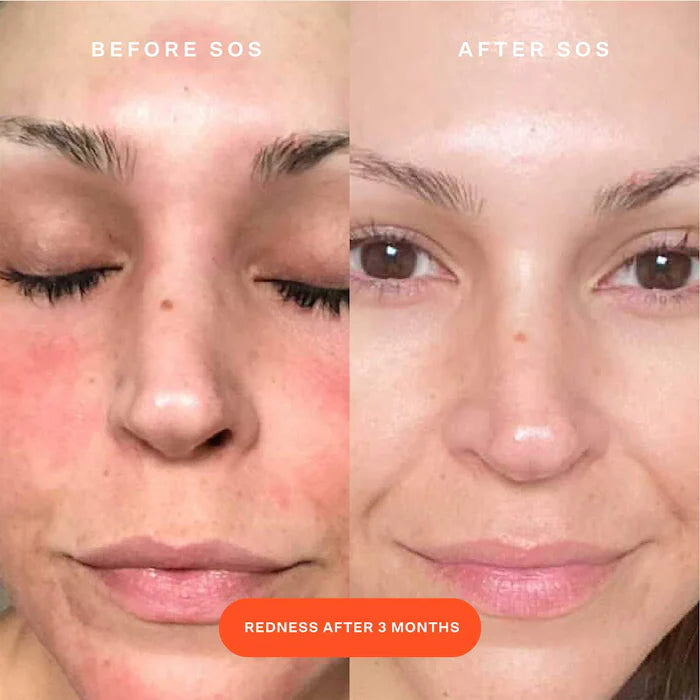 SOS Daily Rescue Facial Spray with Hypochlorous Acid Volume size