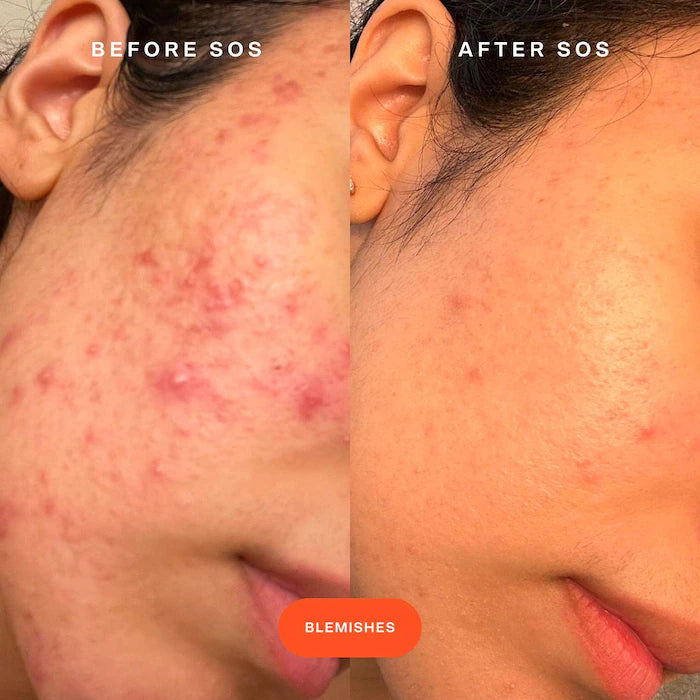 SOS Daily Rescue Facial Spray with Hypochlorous Acid Volume size