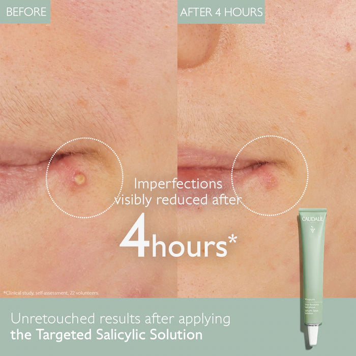 Vinopure Color Correcting Spot Solution with Salicylic Acid