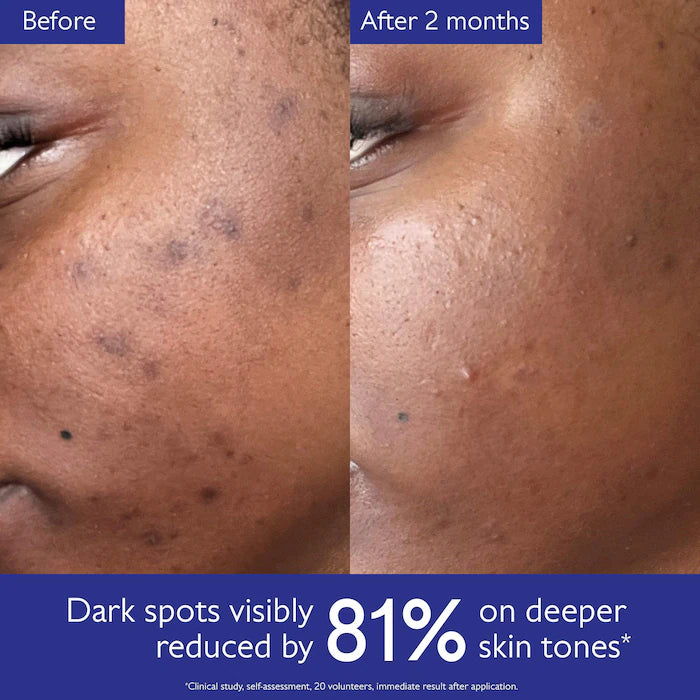 Vinoperfect Brightening Dark Spot Serum Vitamin C Alternative