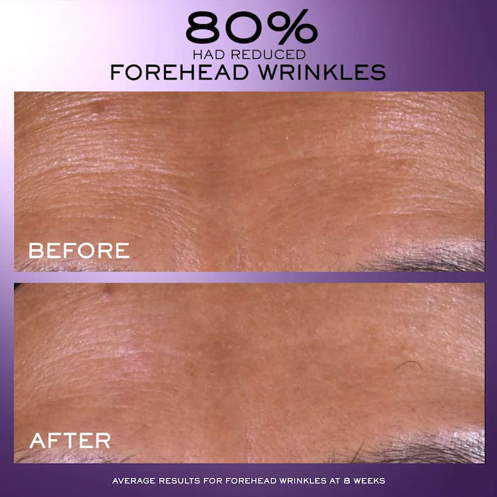 Renergie C.R.X. Triple Serum Retinol