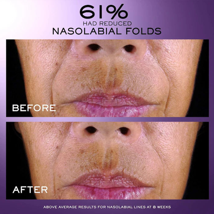 Renergie C.R.X. Triple Serum Retinol