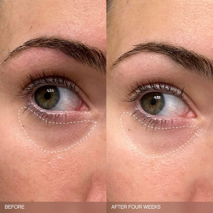 Faded Brightening Bundle for Discoloration on Face & Body
