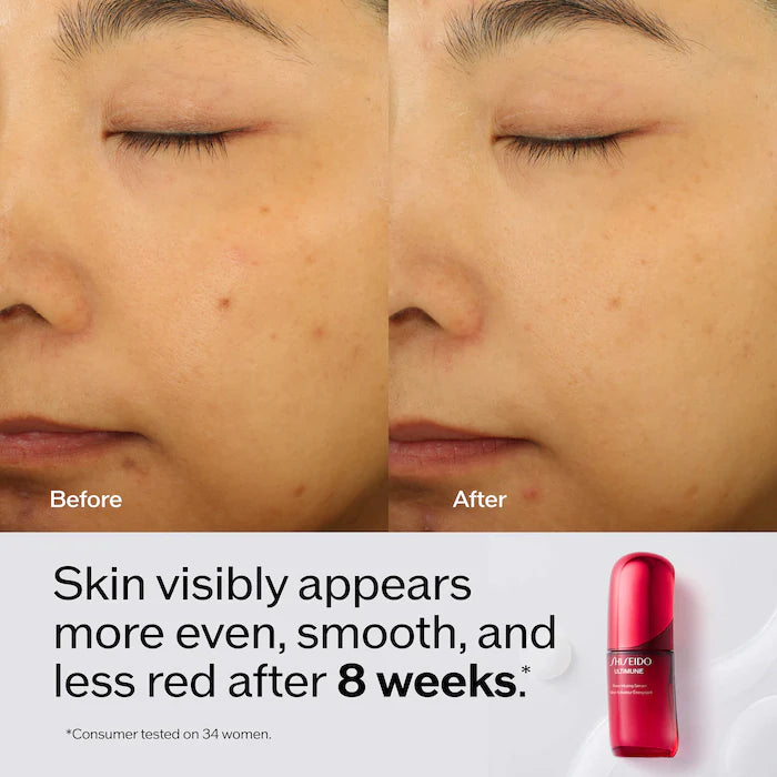 Ultimune Power Infusing Serum for Radiance & Wrinkles