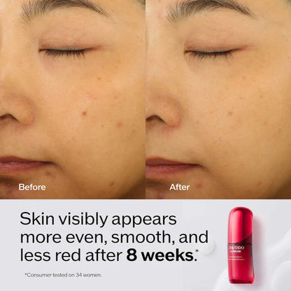 Ultimune Power Infusing Serum for Radiance & Wrinkles