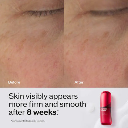 Ultimune Power Infusing Serum for Radiance & Wrinkles