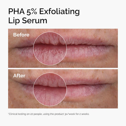 PHA 5% Exfoliating Lip Serum