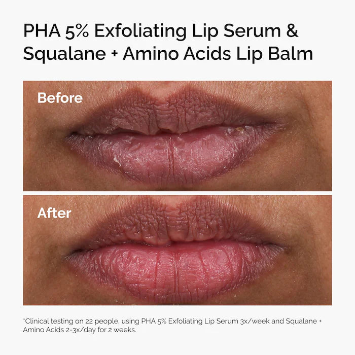 PHA 5% Exfoliating Lip Serum