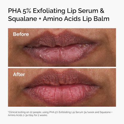 PHA 5% Exfoliating Lip Serum